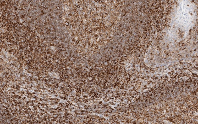 Figure 1. Immunostaining of human tonsil tissue in paraffin section with HC10 (dilution 1:20.000).